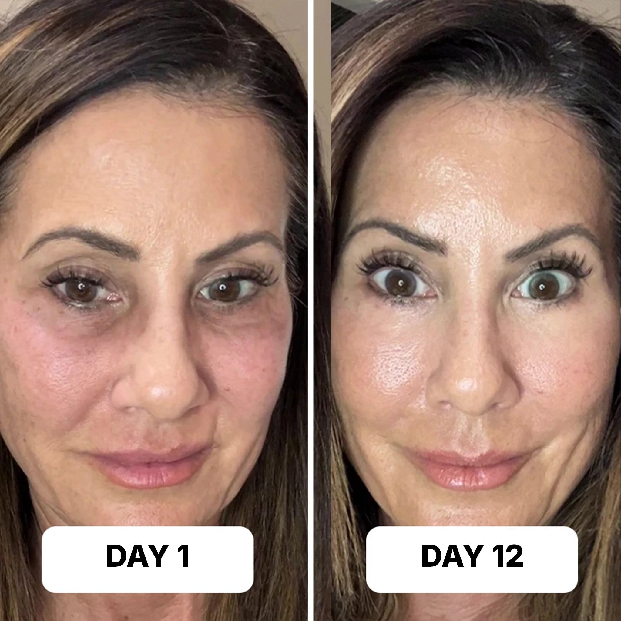 EyeLift™ Red Light + EMS Under-Eye Glasses