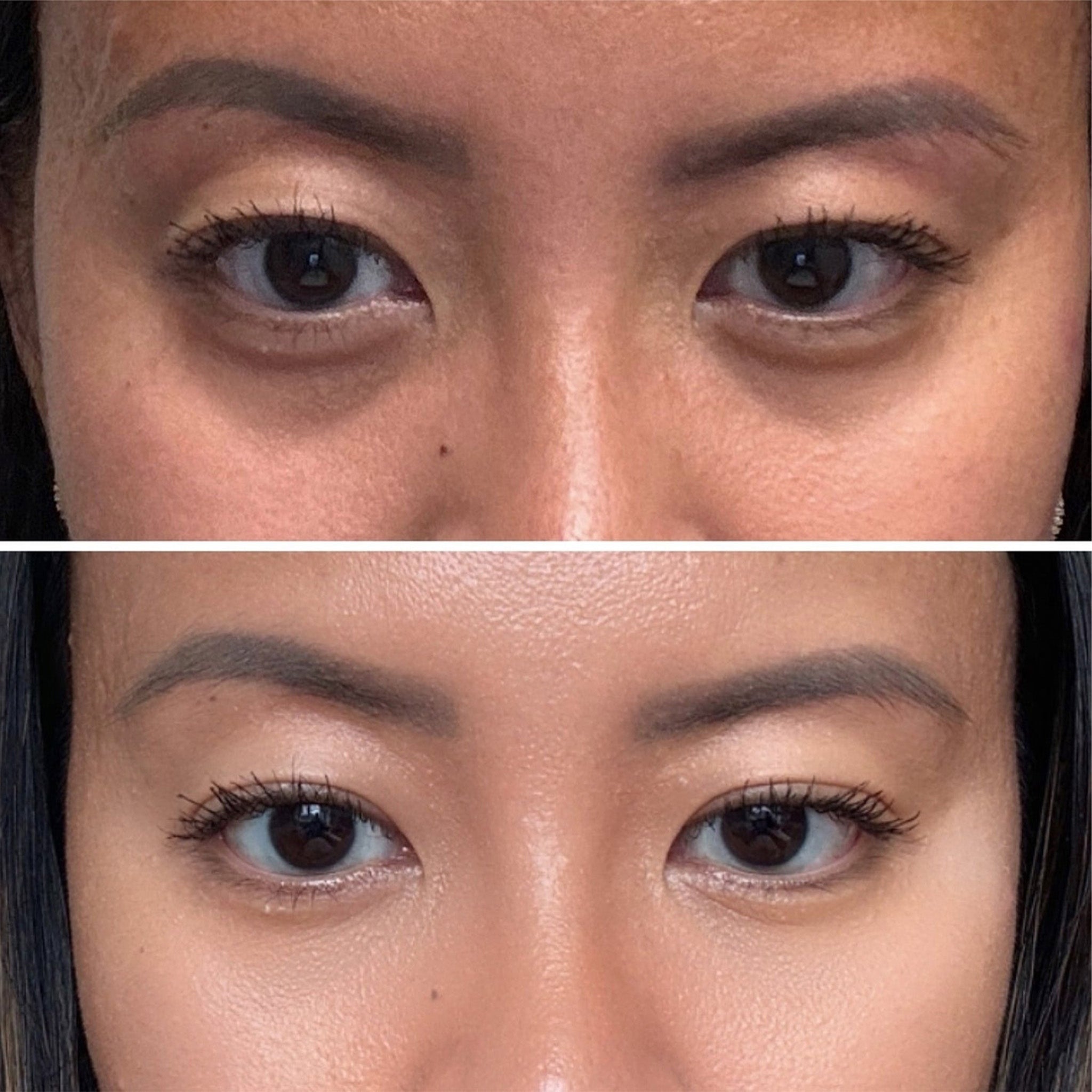 EyeLift™ Red Light + EMS Under-Eye Glasses